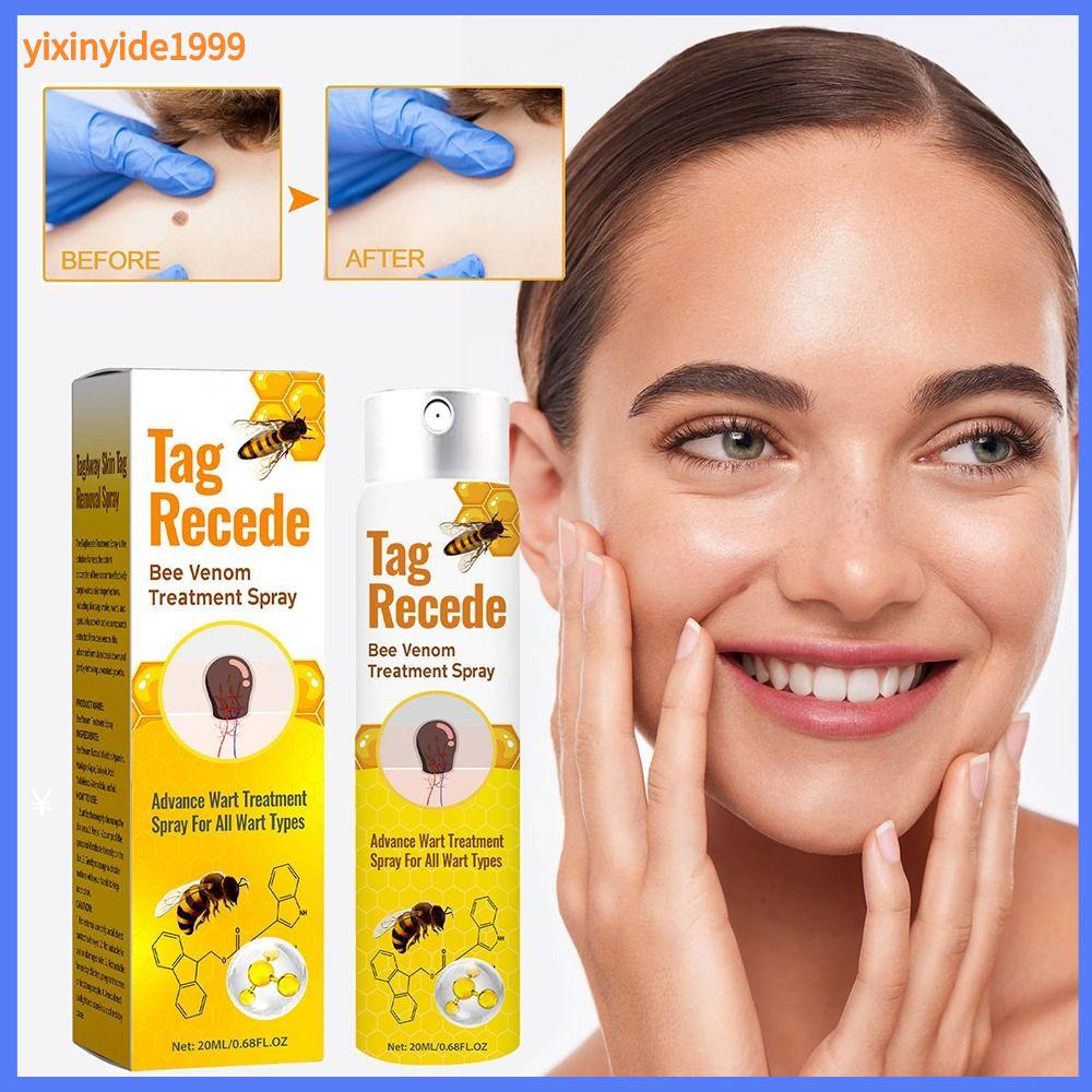 20ML%20Mole%20Skin%20Tag%20Recede%20Bee%20Venom%20Spray%20Painless%20Remover%20Dark%20Spot%20Warts%20Remover%20Effective%20Freckle%20Tag%20Recede%20Bee%20Venom%20for%20Face%20-%20Image%203