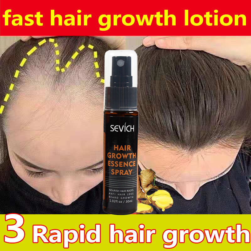 💖One drop for hair growth💖 Hair growth spray Hair Growth Essential Oils Hair  Growth Serum growth serum original essence oil hair growth spray prevents hair  loss and promotes hair growth For All