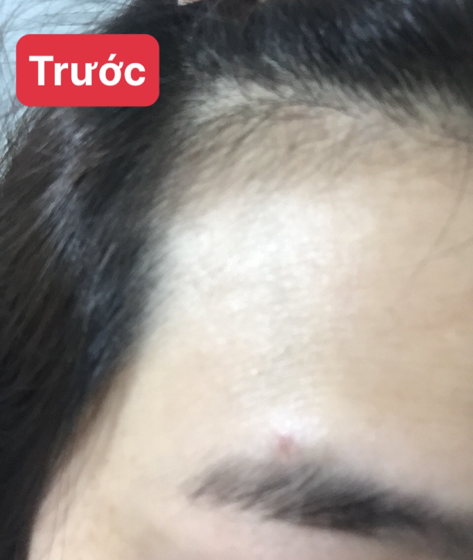 Tinh Dầu Trị Rụng Tóc & Kích Mọc Tóc Kiều Linh