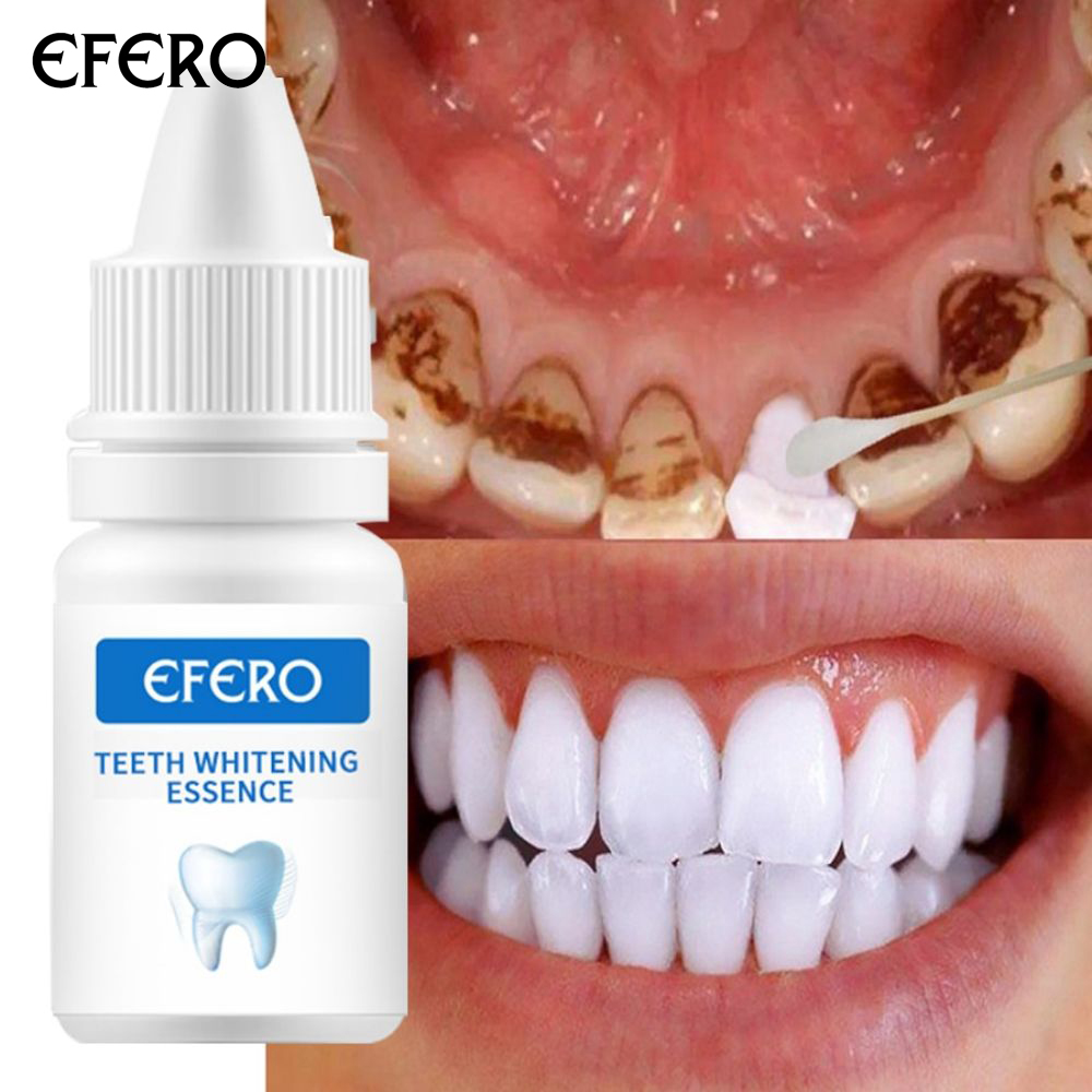 EFERO Gel Serum Làm Trắng Răng Loại Bỏ Vết Ố Răng Và Mảng Bám Làm Sạch thumbnail