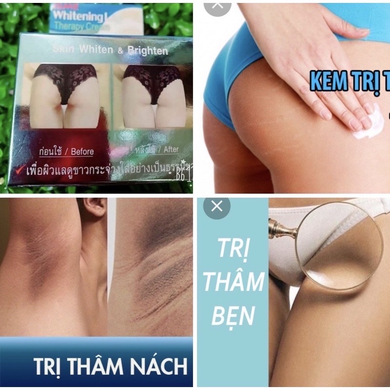 Kem Giảm Thâm Trắng Da Mông 5g