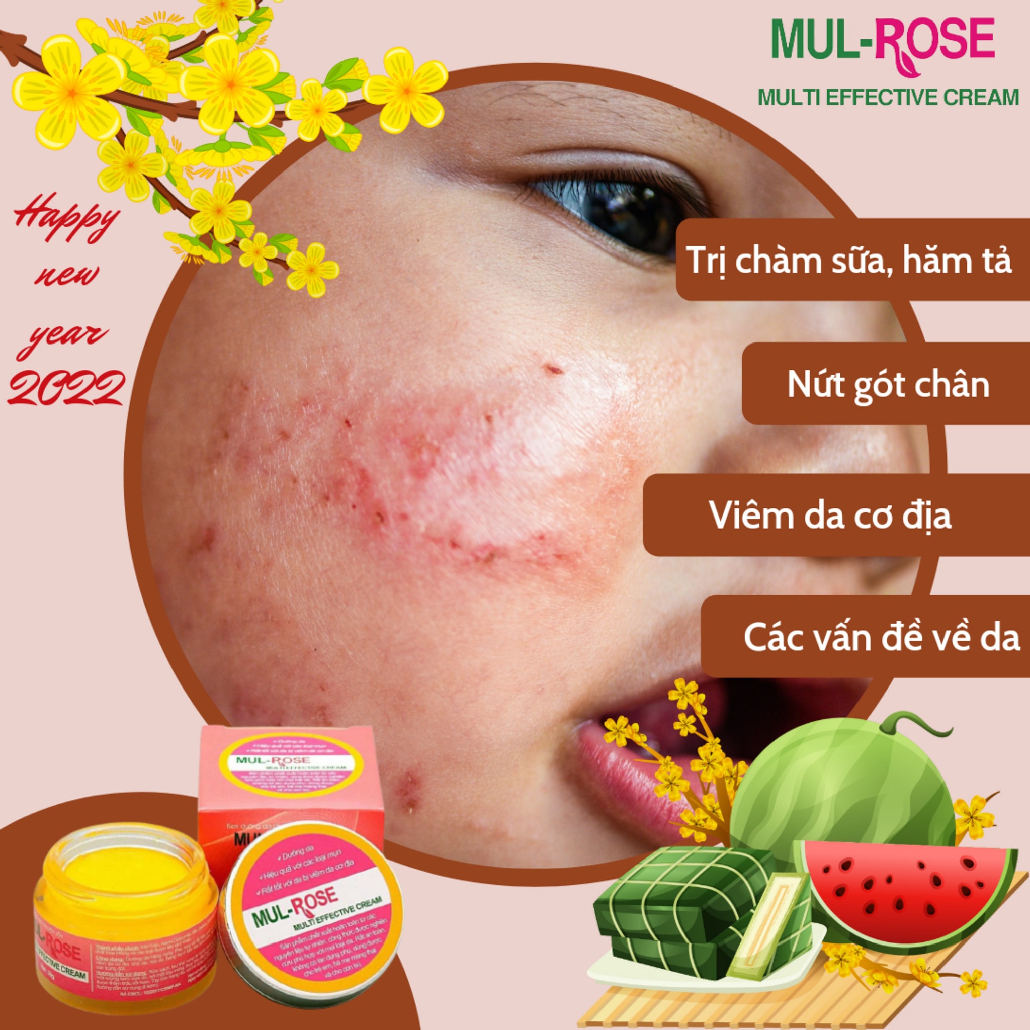 Kem đa năn.g nghệ Muil Rose.Cứu tinh cho mọi làn da