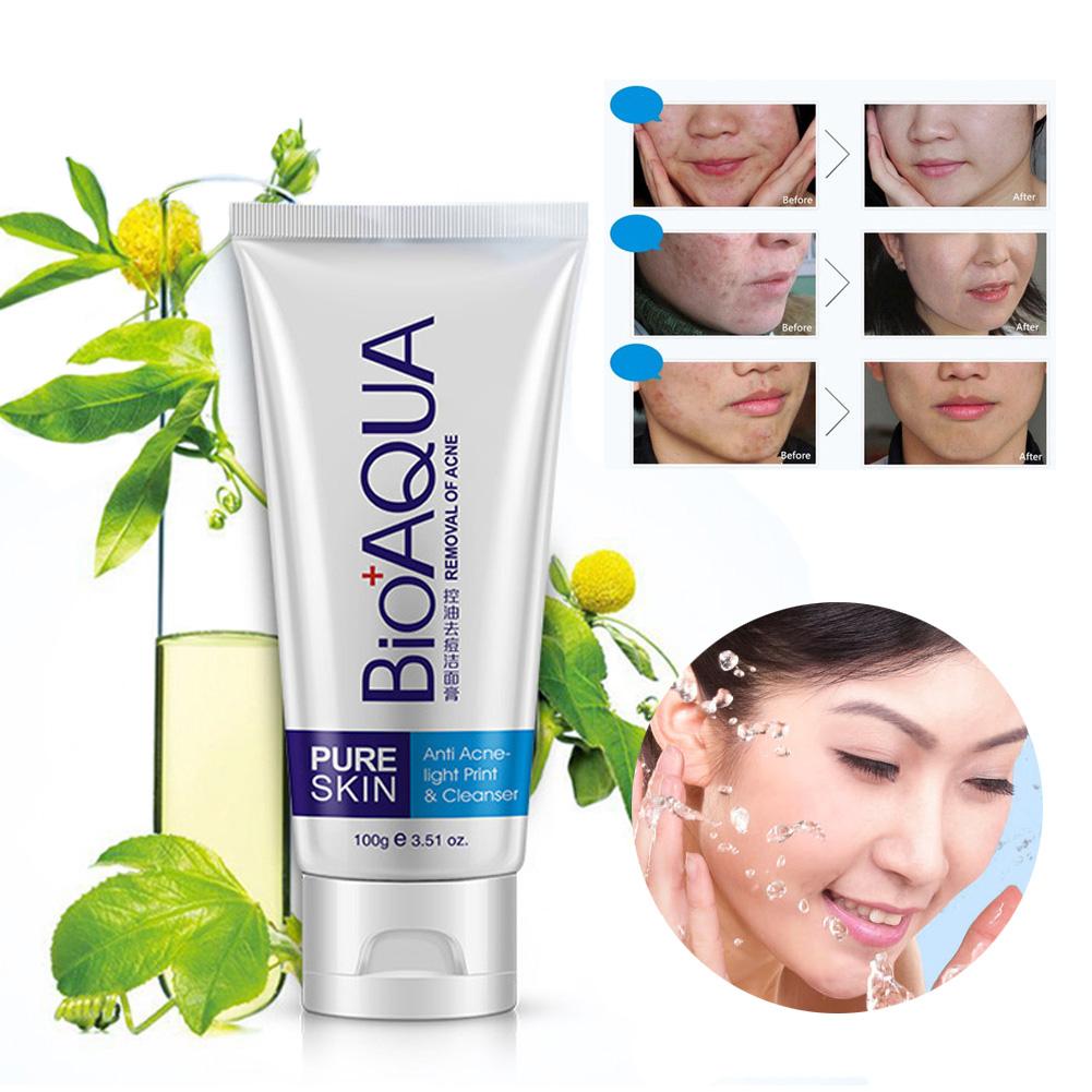 bioaqua pure skin anti acne