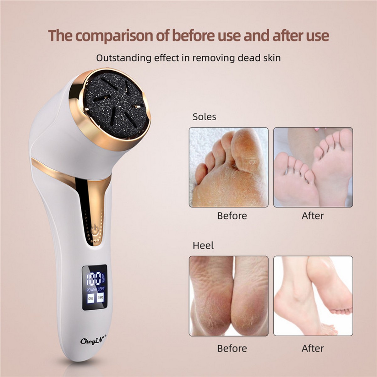 【Essential Good Item】CkeyiN Electric Pedicure Tools Foot Care Leg Heels ...