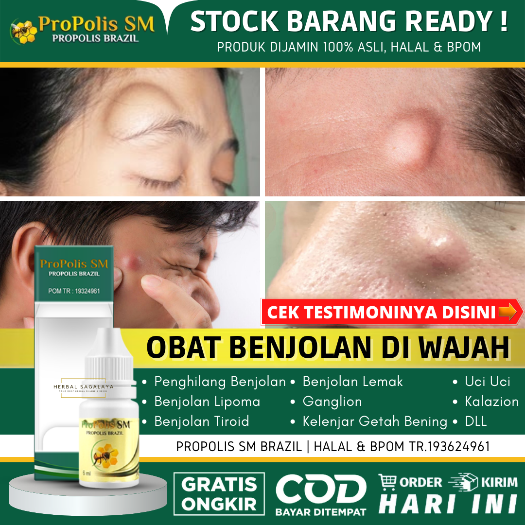 Obat Penghilang Benjolan Di Wajah 100% Alami & Aman - Obat Benjolan ...