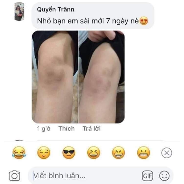 KEM TRỊ THÂM NÁCH, THÂM MÔI, THÂM NHŨ HOA HÀN QUỐC - Ol+Cell