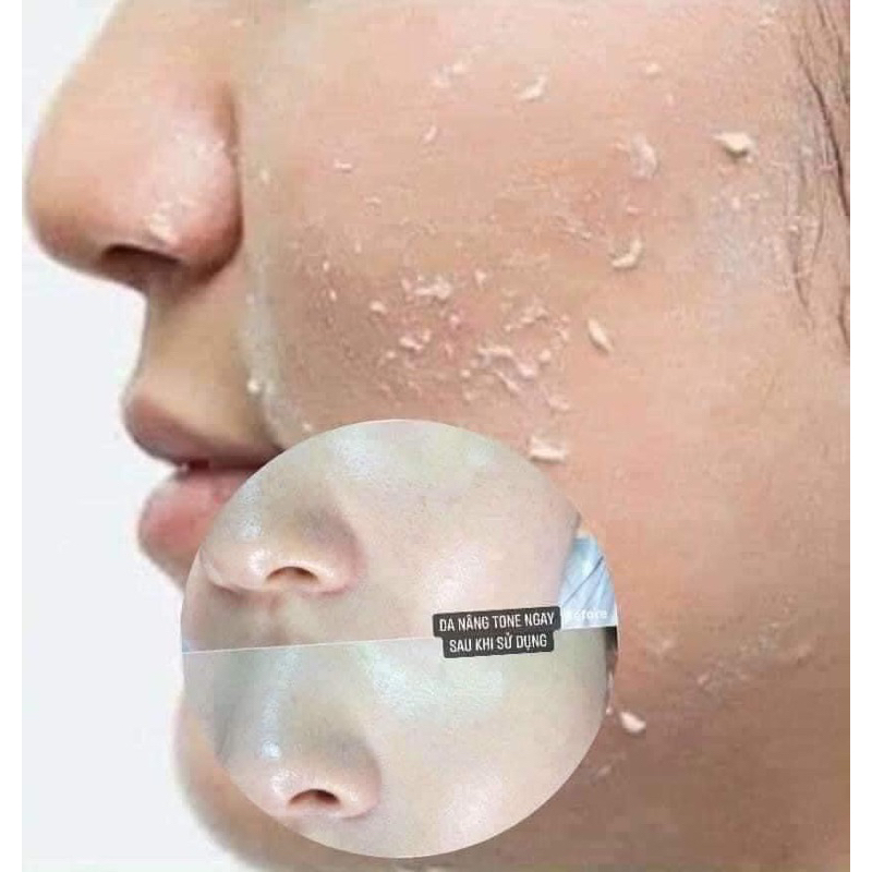 (TÚI 10 GÓI) TẨY DA CHẾT WHOO BRIGHTENING GEL