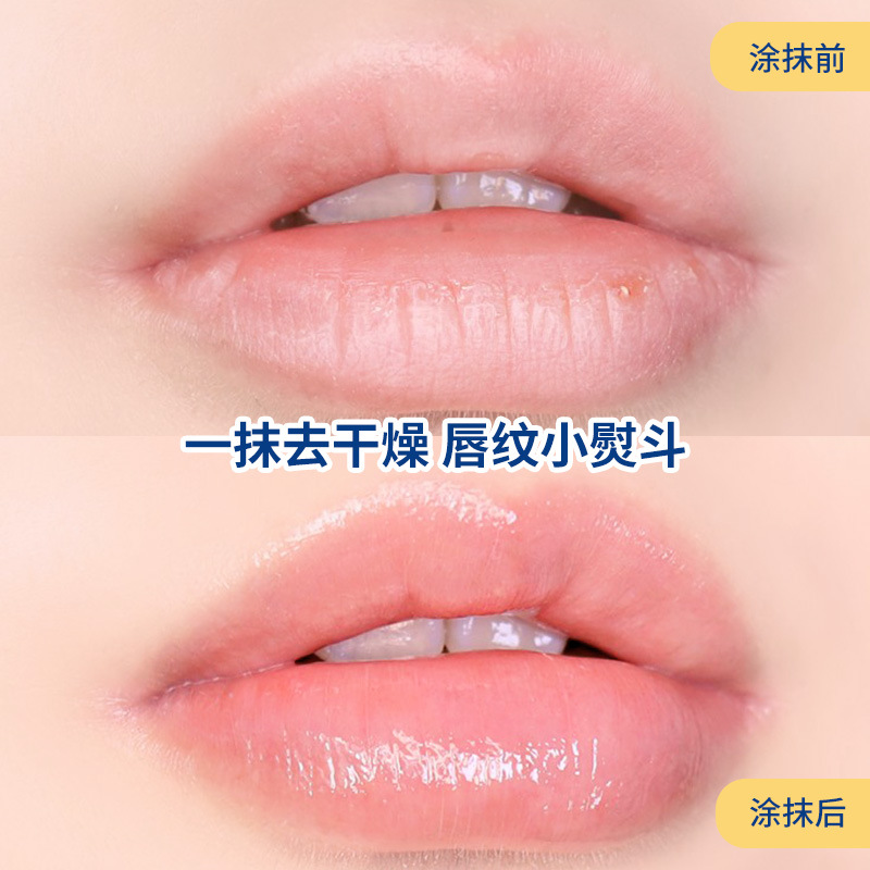Vaseline Dưỡng Môi 7g Giúp Dưỡng Môi Hồng