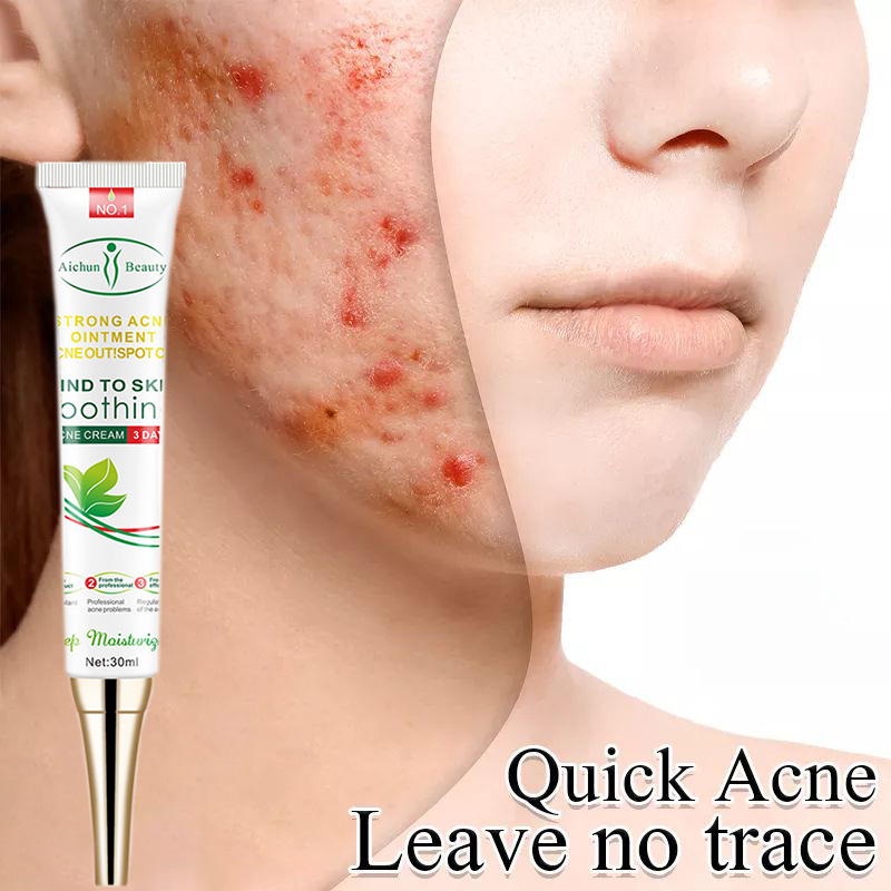 Acne cream pimple eraser pimple marks remover Pore Control Exfoliating