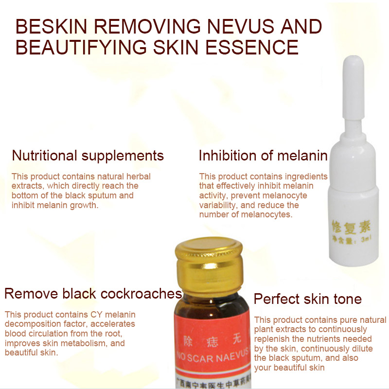 Mole Remover Set Skin Care Tags Warts Removal Repair Solution Kit