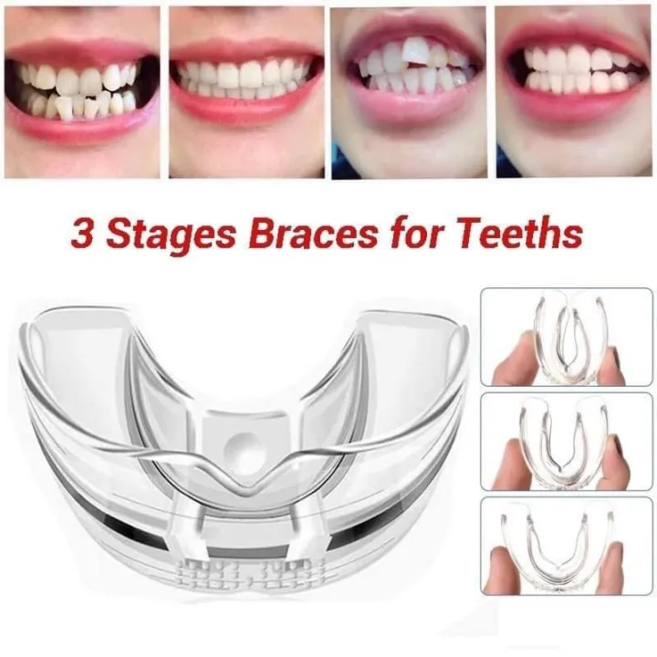 (A3, third stage, hard braces)Teeth retainer dental health care brace Teeth Alignment Trainer Retainer Mouth Guard Dental Care. 