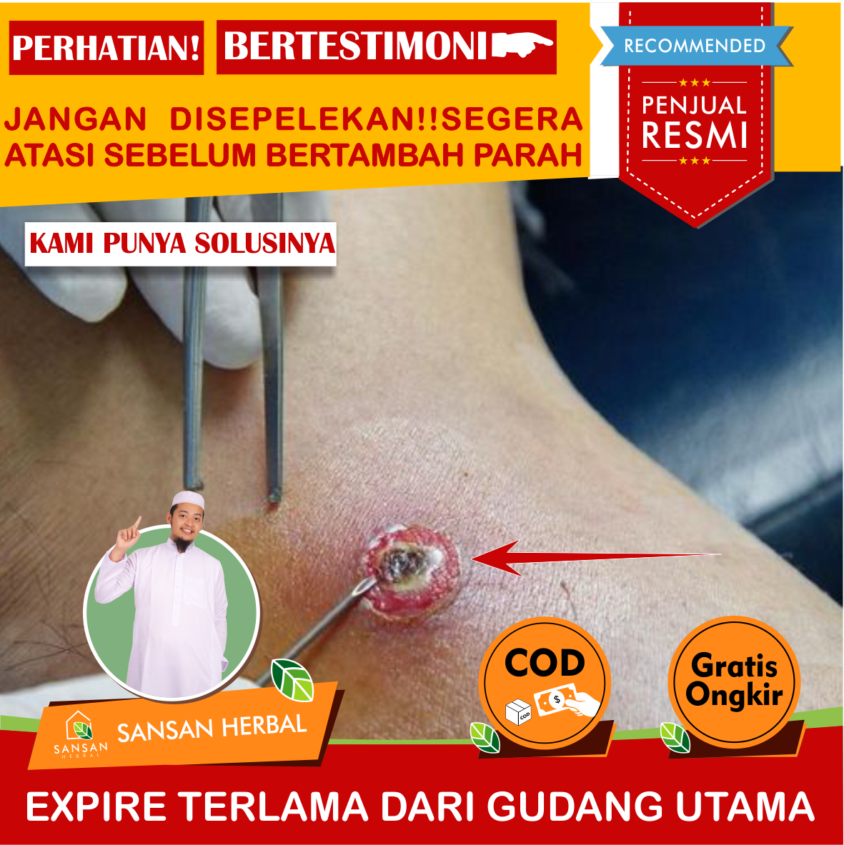 Salep Luka Bisul, Salep Untuk Luka Bisul, Obat Mengeringkan Luka Bisul