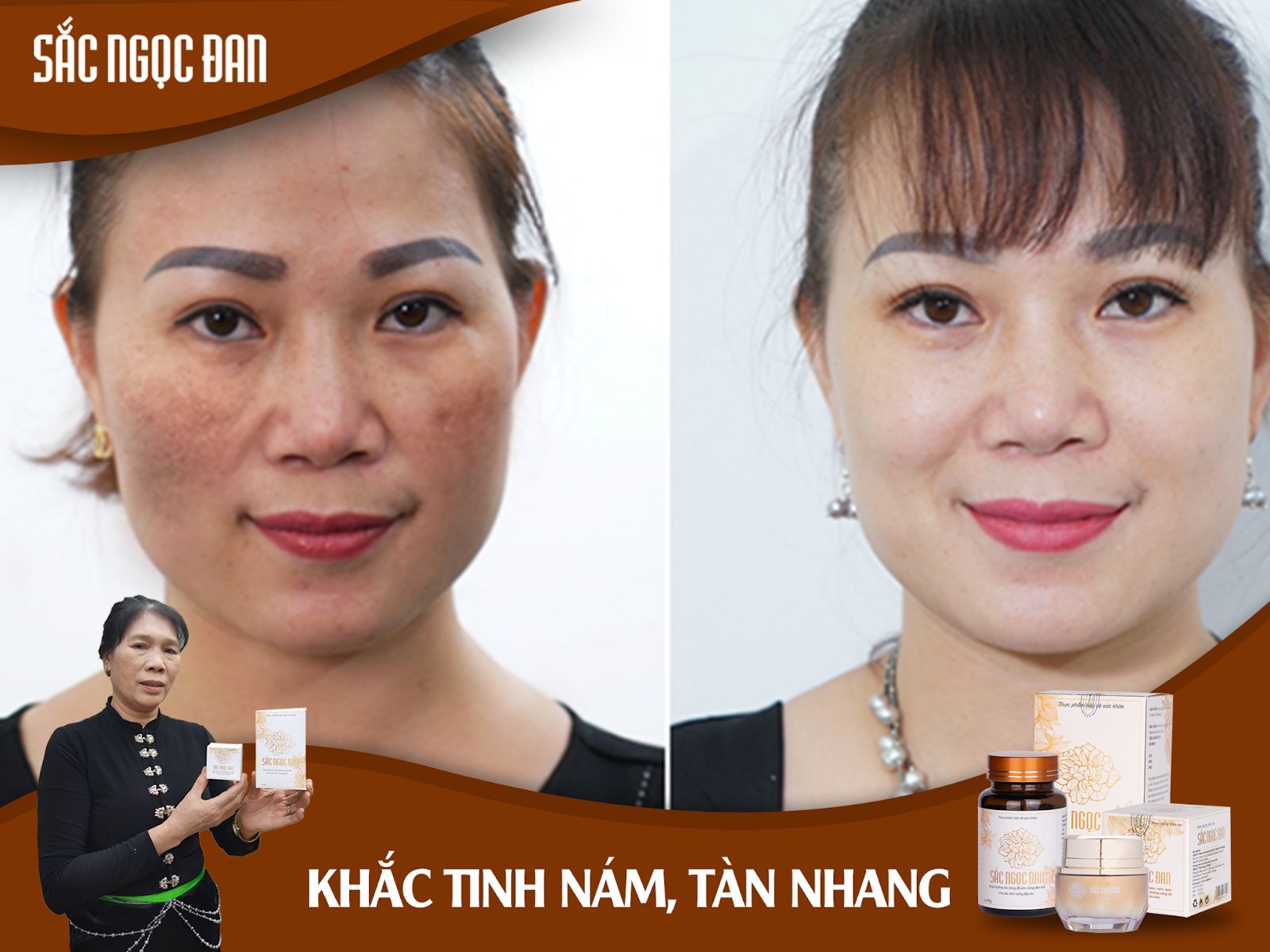 Sắc Ngọc Đan - Xóa mờ thâm nám, tàn nhang