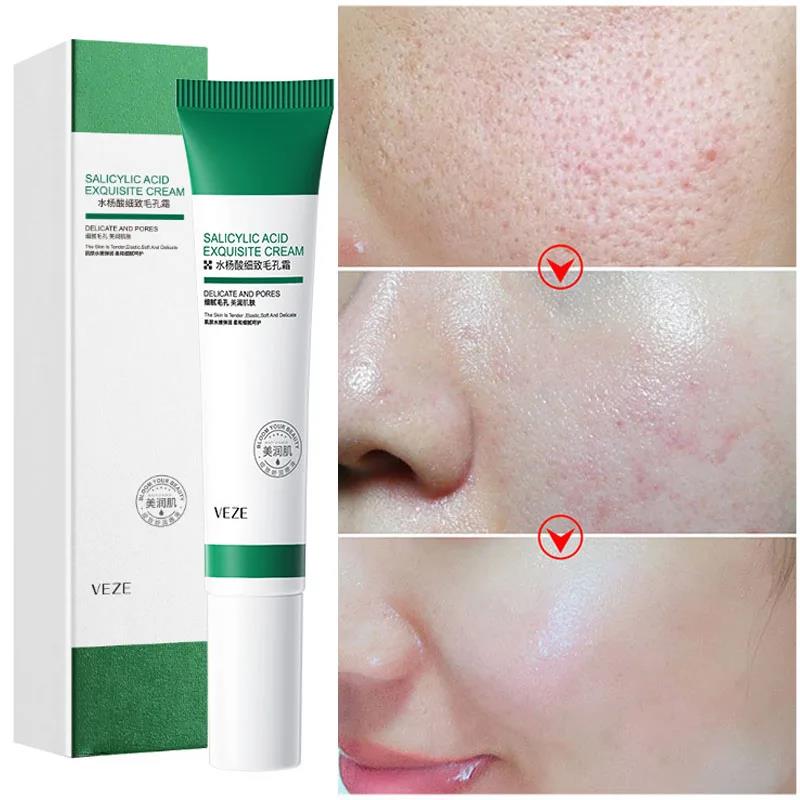 Salicylic Acid Pores Refining Cream Shrink Pore Improve Acne Blackheads Oil Control Cream Moisturizing Face Skin Care 20ml. 