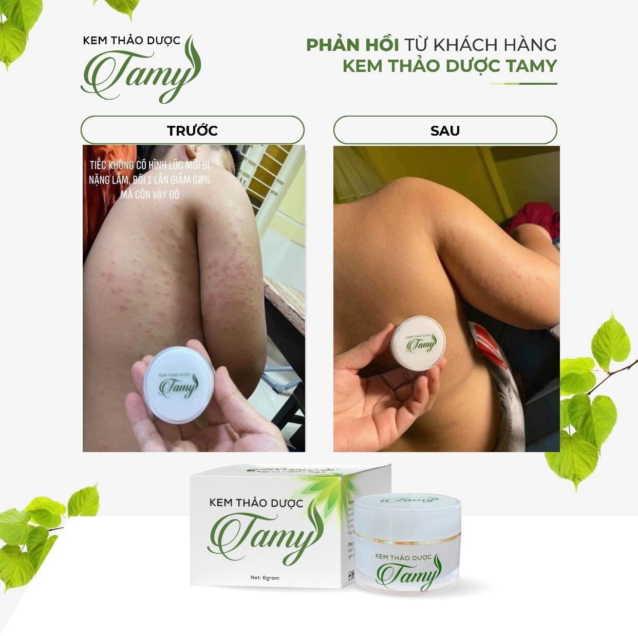 Tamy Herbal Cream