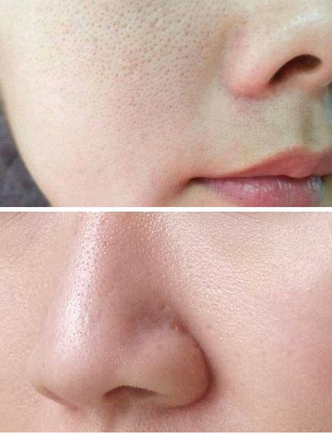 KEM THU NHỎ LỖ CHÂN LÔNG SQS NHẬT BẢN