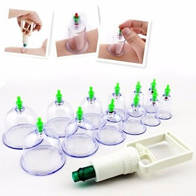 [HCM]BỘ DỤNG CỤ GIÁC HƠI -KHÔNG DÙNG LỬA - 12 Ống