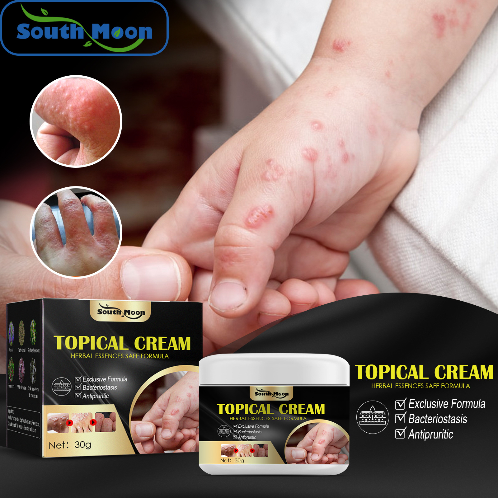 South Moon Topical Cream Mosquito Cream Children Adults Repellent Fast