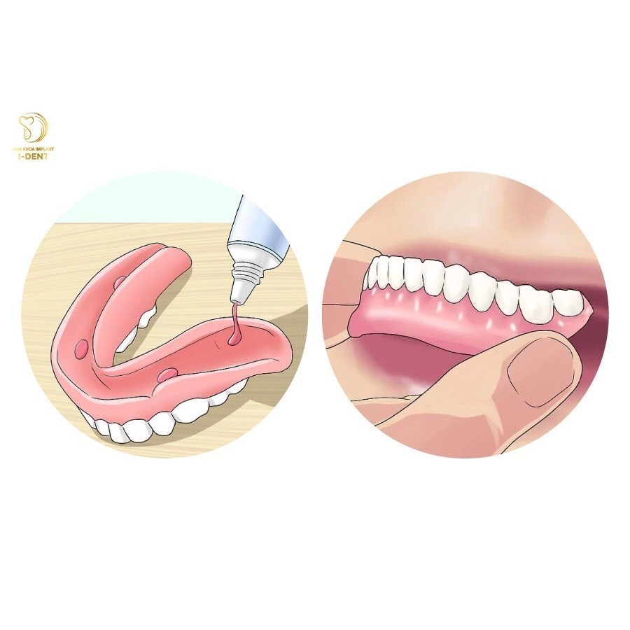 ✅ Keo Dán Răng Fixodent (USA) | Dán Hàm Giả -VT0311 - Y Tế Vạn Thành