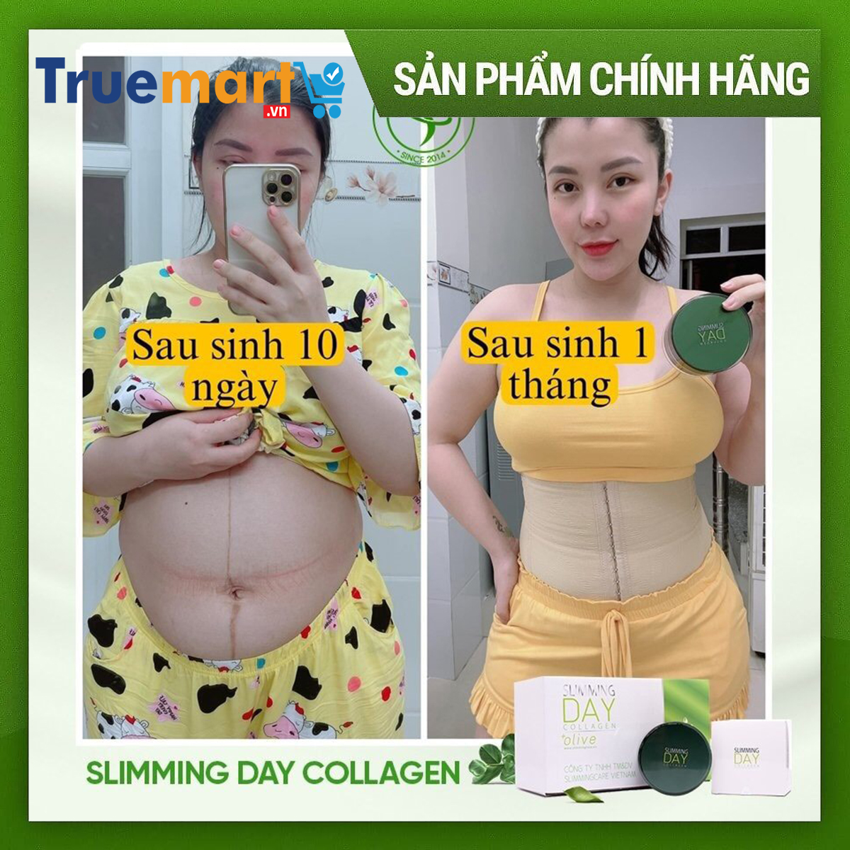 Bộ đai định hình tan mỡ, mờ rạn Slimming day collagen (SDC)