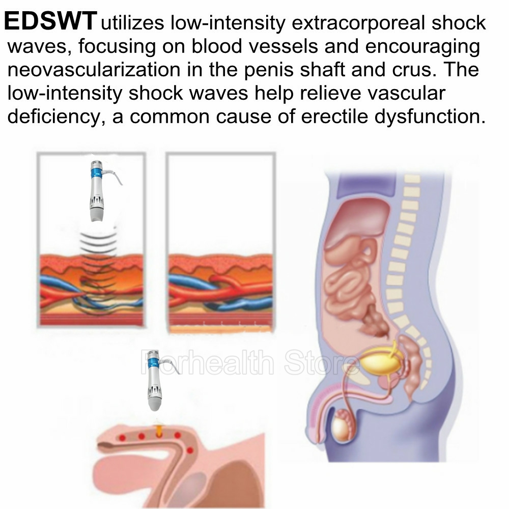 Shockwave Therapy Machine Accessory ED Silicone Massage Head Treatment Erectile Dysfunction For Shock Wave Therapy 2021 New. 