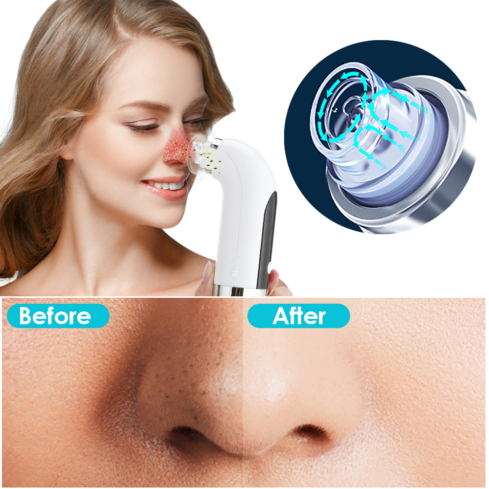 Electric%20Small%20Bubble%20Blackhead%20Remover%20Vacuum%20Suction%20Water%20Cycle%20Pore%20Cleaner%20Acne%20Pimple%20Black%20Head%20Removal%20Tool%20Rechargeable%20-%20Image%203