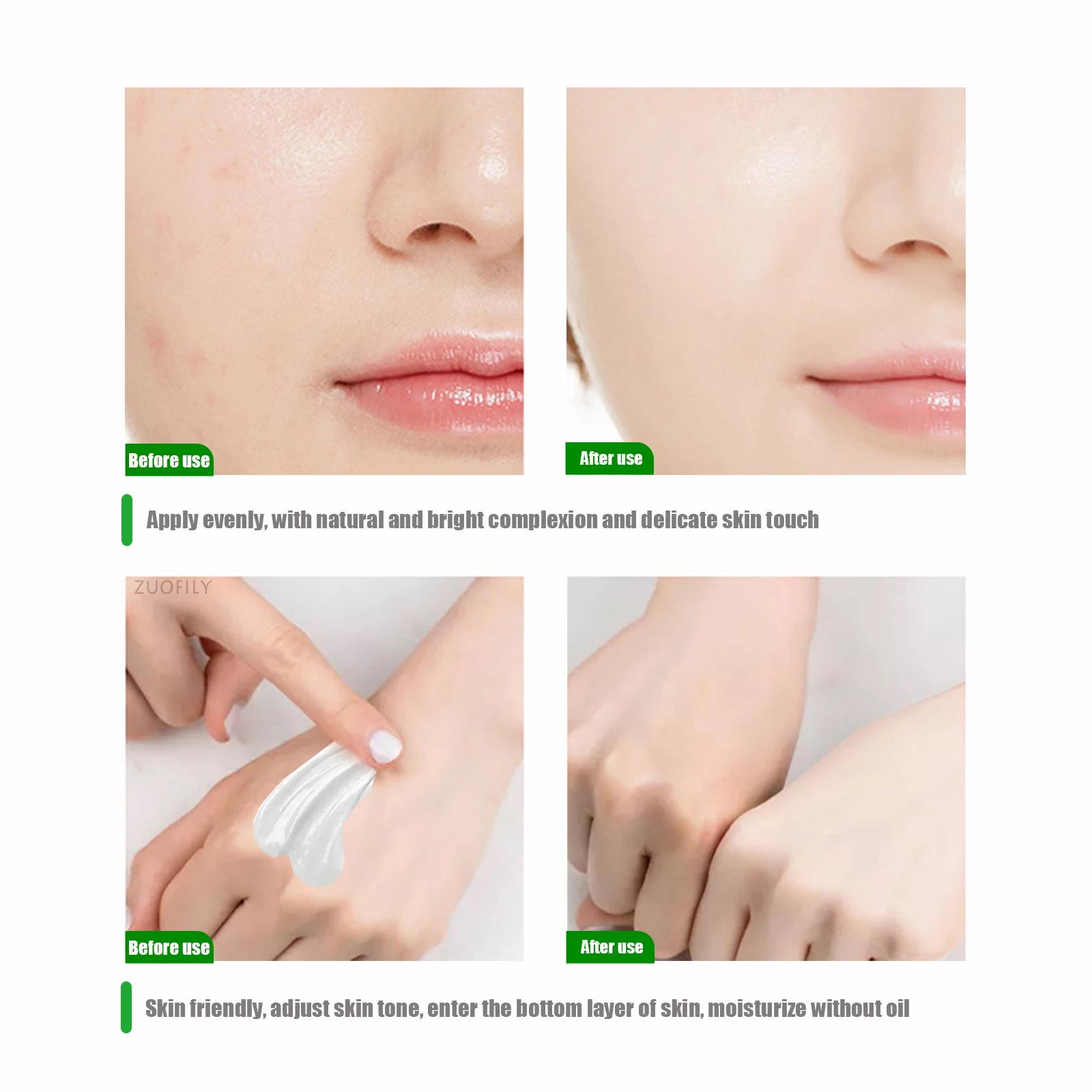 Body%20Creams%20Underarm%20Legs%20Knee%20Elbow%20Brighten%20Armpit%20Remove%20Melanin%20Pigmentation%20Improve%20Dull%20Brighten%20Body%20Skin%20Care%20Hot%20Selling%20-%20Image%206