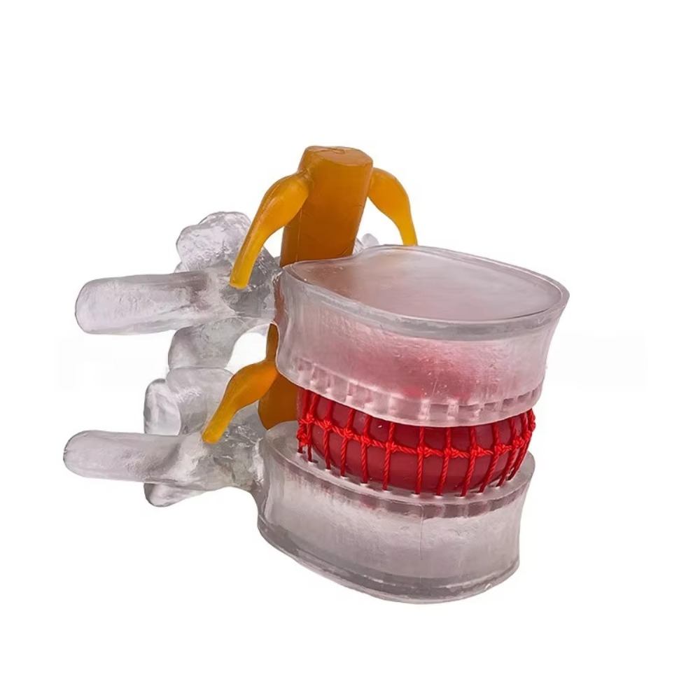 High%20Quality%203D%20Model%20Lumbar%20Model%20Compression%20Demonstration%20.5X%20Enlarge%20Human%20Anatomy%20Skeleton%20Model%20Spinal%20Pressure%20Lesions%20Simulation%20Lumbar%20Disc%20Herniation%20Teaching%20Tool%20Nursing%20-%20Image%209