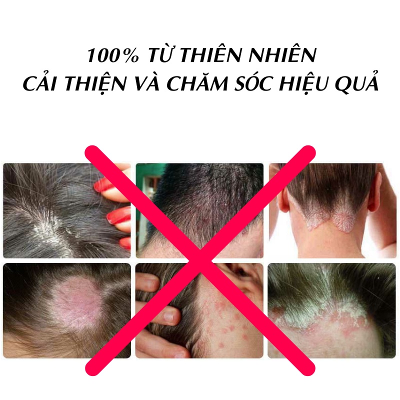 [Hàng sạch chất lượng cao] Bồ kết trái khô 1kg - Tấn Phát - Hàng công ty chất lượng cao