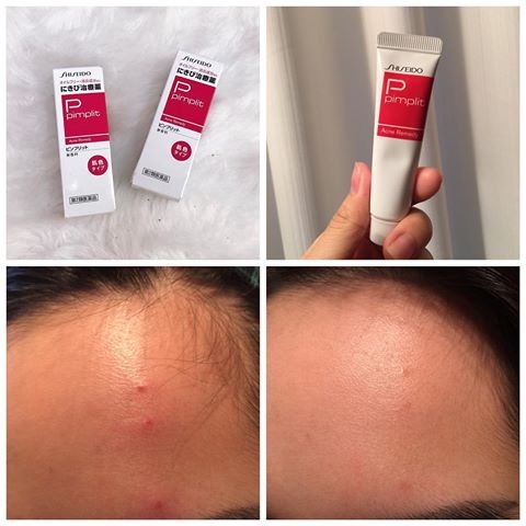 Kem Chấm Mụn Shiseido Pimplit Nhật Bản - Tuýp 18g