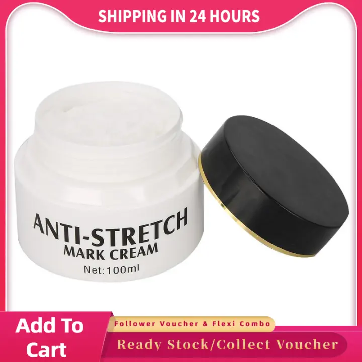 skin stretch marks removal cream