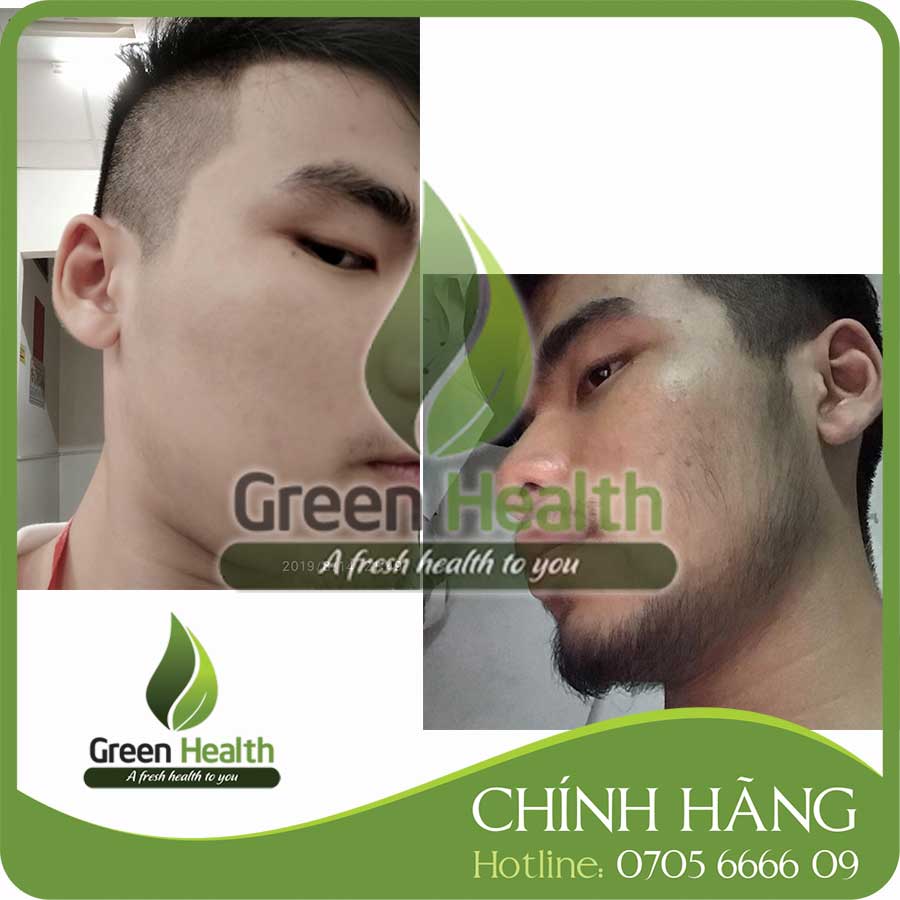 (Giveaway Peo Mix) Tugain Minoxidil 10% Solution to Support Beard and Hair Growth Minoxidil 10% Tugain