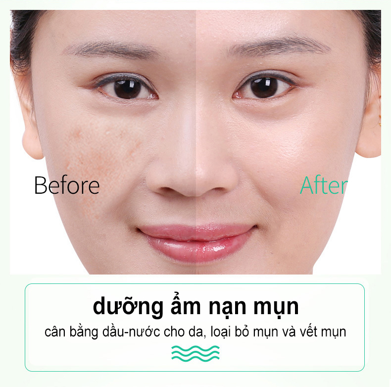 gel lô hội