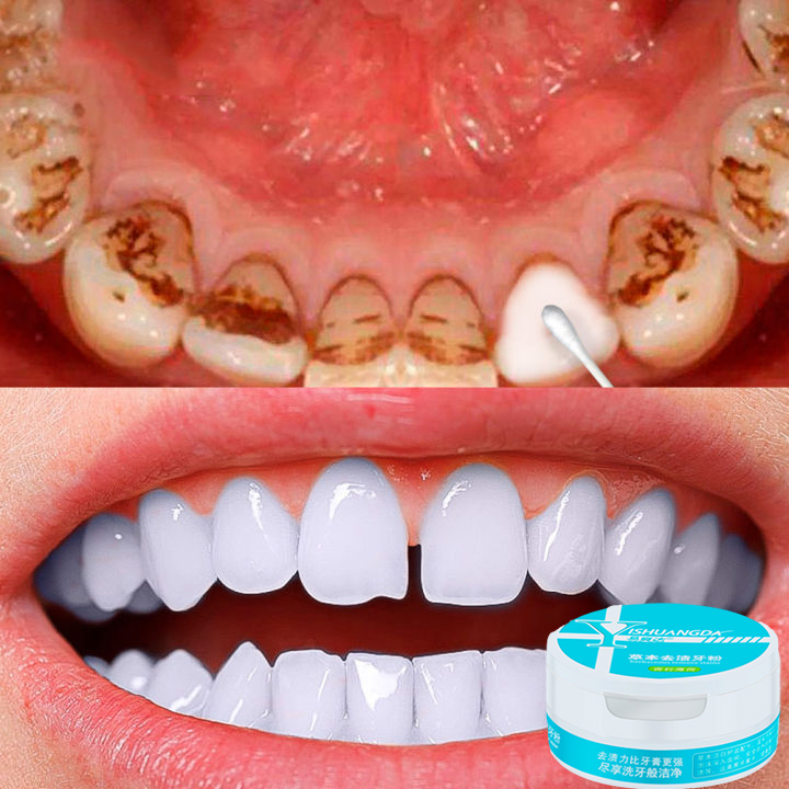 Bột trắng răng, làm trắng, làm sạch khoang miệng, ngăn ngừa vi khuẩn sâu răng, bột tẩy trắng răng 50g thumbnail