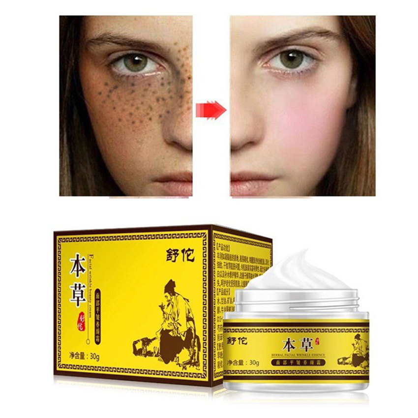 UIEEPGP Fa-cial Dark Spot Removal Whitening Cream Face Care Freckle Repair Treatment