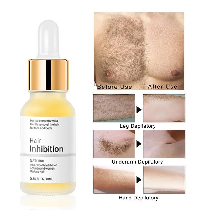 HeYang Permanent Hair inhibition Serum Painless Hair Remover Armpit Legs Arms Hair Growth Inhibitor Beauty Skin Care Body Essential Oil phone case.