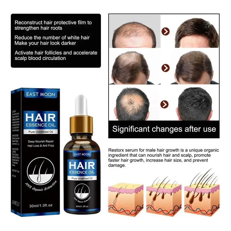 7-day Rapid Hair Growth Essential Oil Hair Regeneration Oil Anti-hair Loss Mild Repairs Hereditary Hair Essential Oil New. 