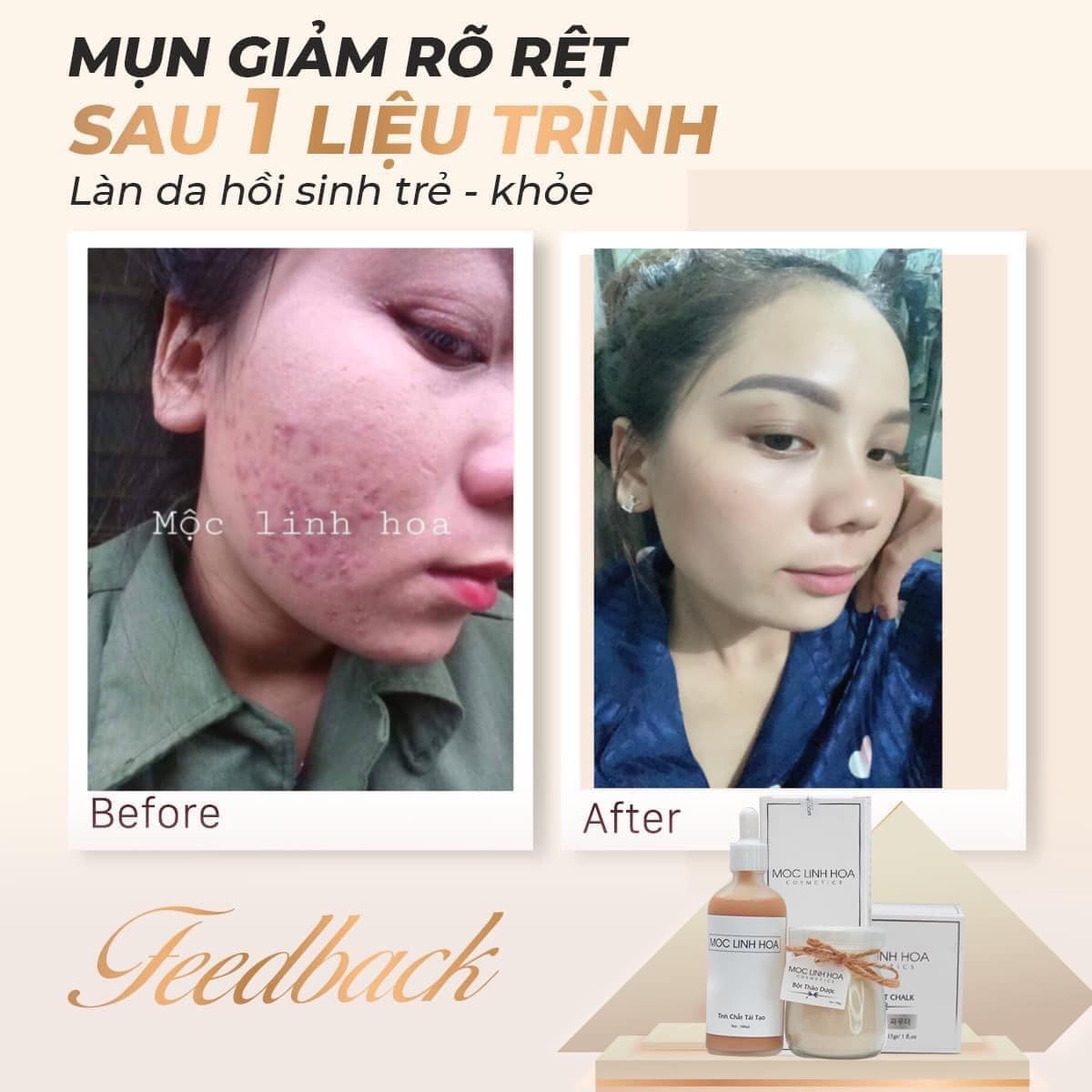 Bộ Tái Tạo Da