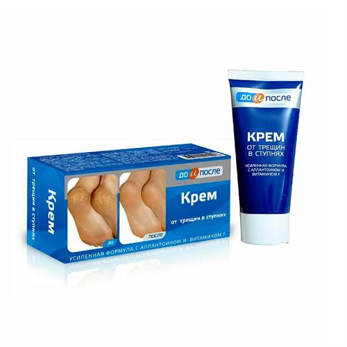 [FreeshipMAX] Kem mờ nứt gót chân Kpem dưỡng da chân