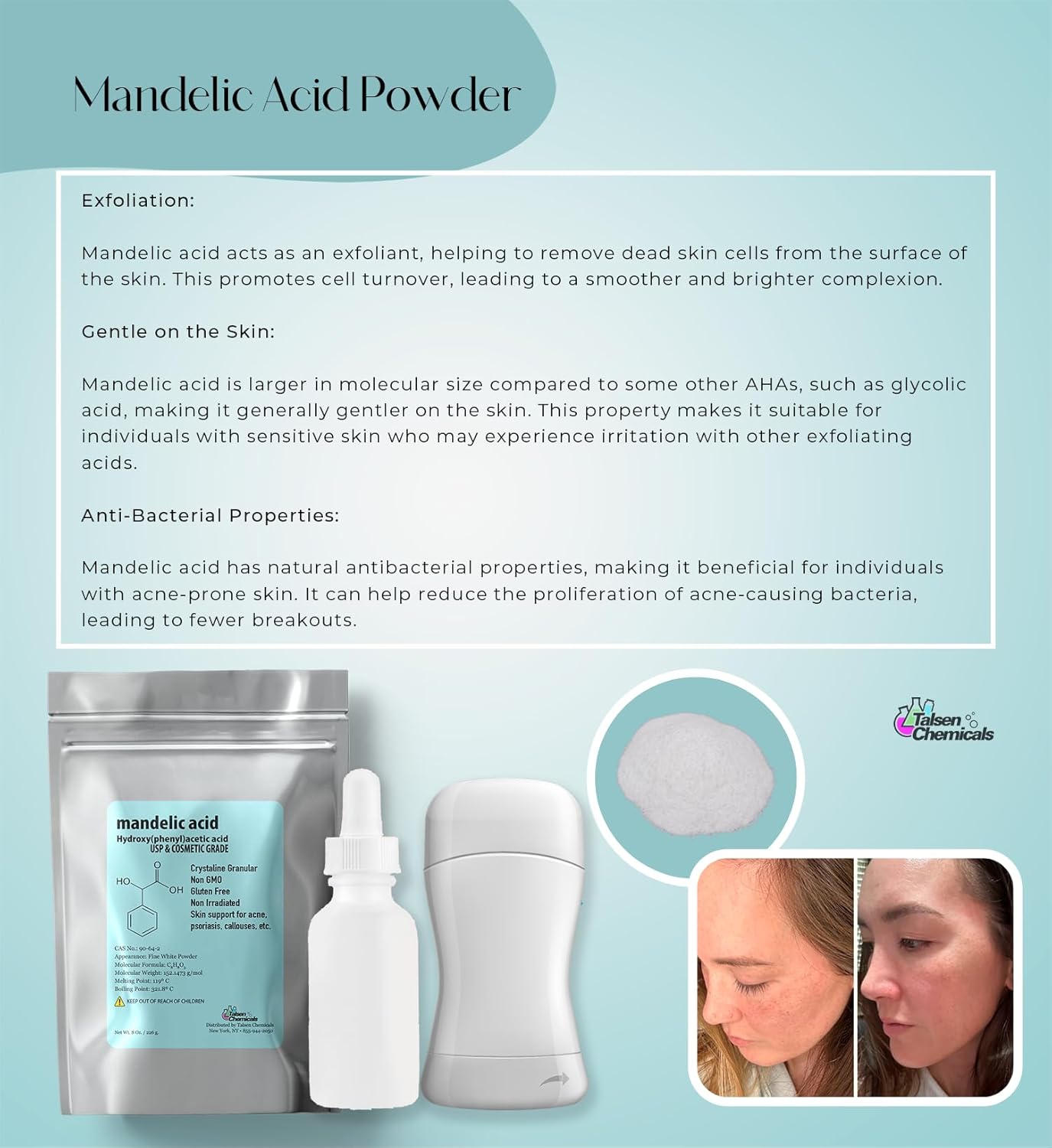 Mandelic Acid Powder 99.9% Purity, DIY Cosmetic Grade For Mandelic Acid Serum, Peel/Mask or add to Cream, Moisturizer (4 Ounce / 113 Gram). 