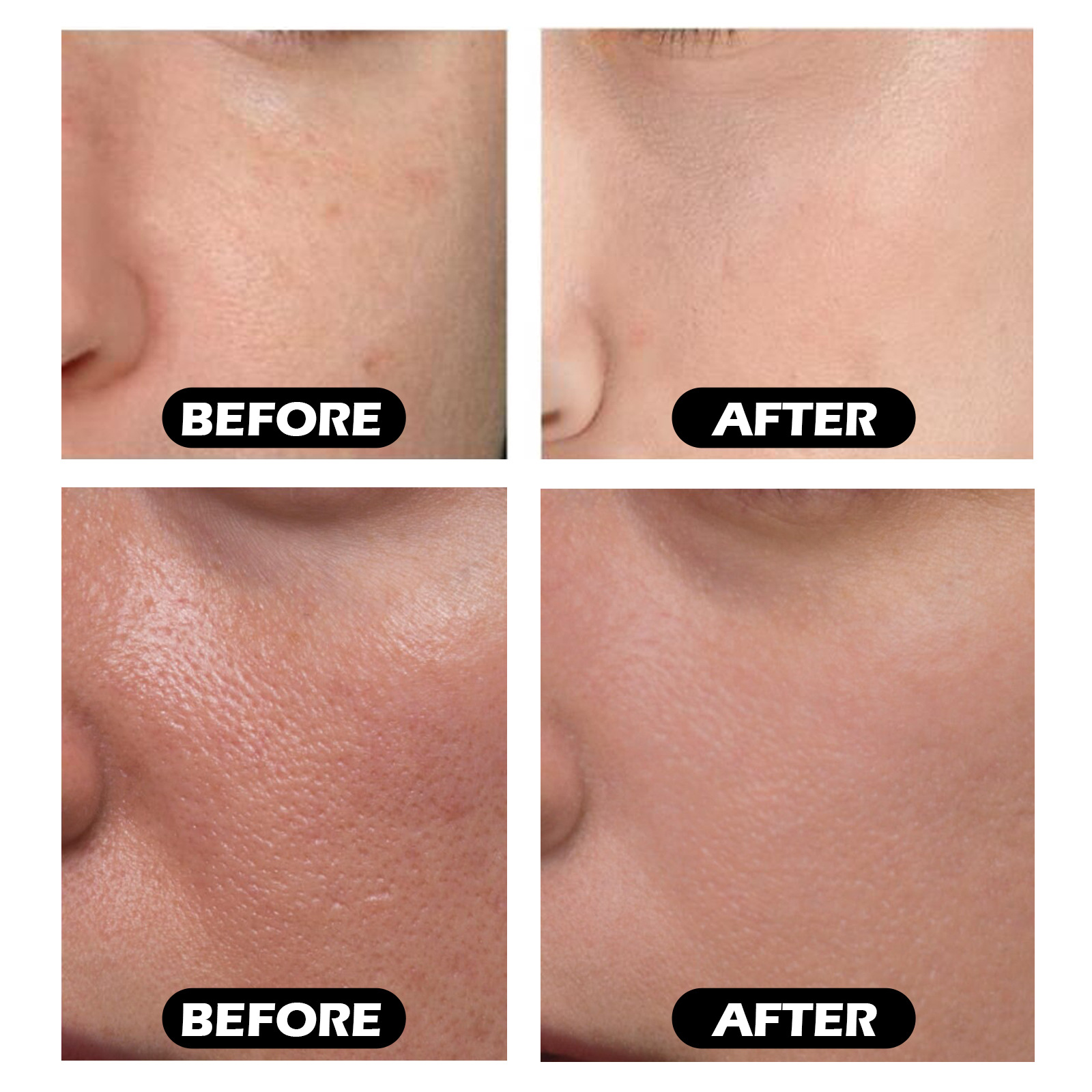 hashmap、hashtable、concurrenthashmap... 【Fashion-forward】West Month Facial Instant Moisturizing Essence Fades ...
