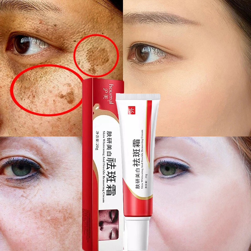 MerMer store Whitening Freckle Cream Melanin Moisturizing Hydrating Skin Care Freckle Cream for Freckles Melasma Dark Spot Skin Discoloration Skin Pigmentation COD