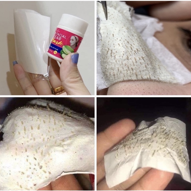 Mặt nạ lột mụn đầu đen Mụn Cám Gel Hút Mụn White Gel Lột Mụn Nha Đam loại bỏ mụn đầu đen Mũi 22g a