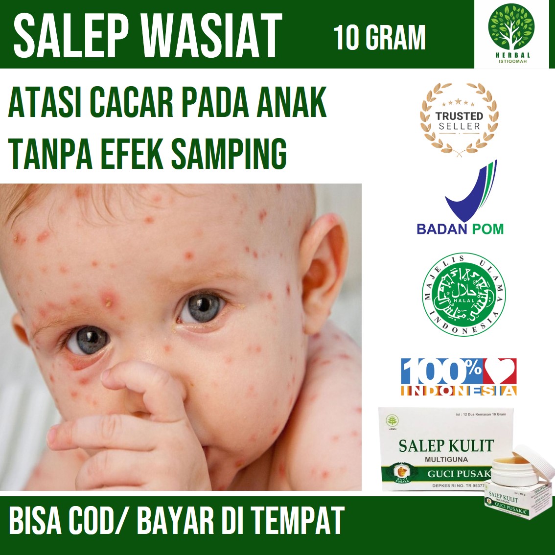 [EFEKTIF] Salep Anti Cacar Kulit Pada Anak Aman Dan Paling Bagus ...