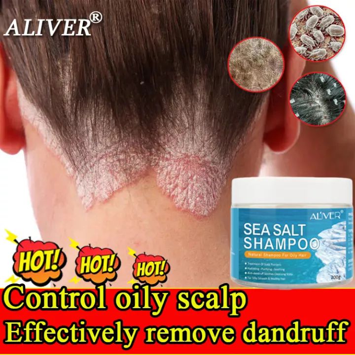 ALIVER Sea Salt Anti Dandruff Shampoo Hair Treatment Shampoo For