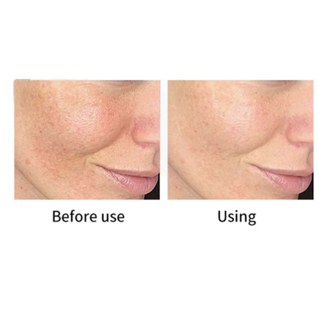 Tinh Chất Pharmaform C-Smoothing Serum Vitamin C + 10% AHA 30ml