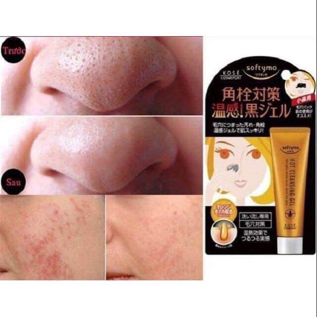 Gel Lột Mụn Cám Kose Softymo Nhật Bản 25G