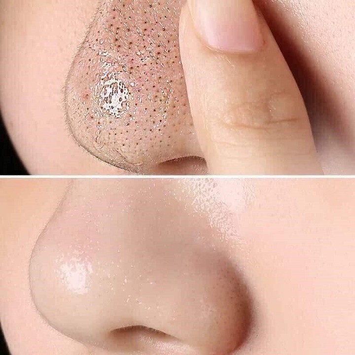 [ Chuẩn hàng Thái ] Gel Lột Mụn Đầu Đen Than Tre Blackhead Mistine