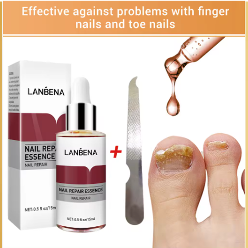 %E3%80%90Exclusive%20Discount%E3%80%91%20LANBENA%20Fungus%20Care%20Remove%20Onychomycosis%20Toes%20Nourish%20Brighten%20Hands%20Feet%20Product%20Repair%20Suitable%20Women%20Nail%20Pepair%20Essencs%20-%20Image%203