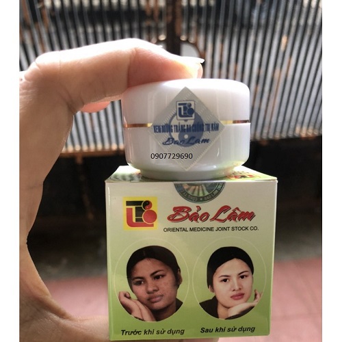 Kem ngừa mụn trắng da Bảo Lâm 10g
